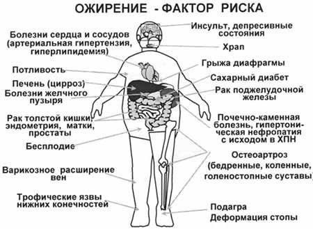 Ожиріння