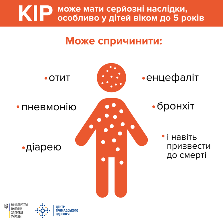 УВАГА - КІР!