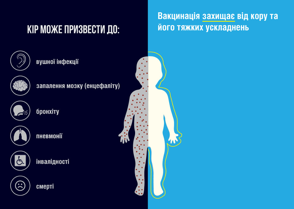 Вакцинація захищає від кору та його тяжких ускладнень