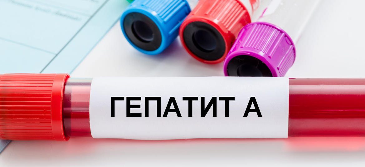 Гепатит А