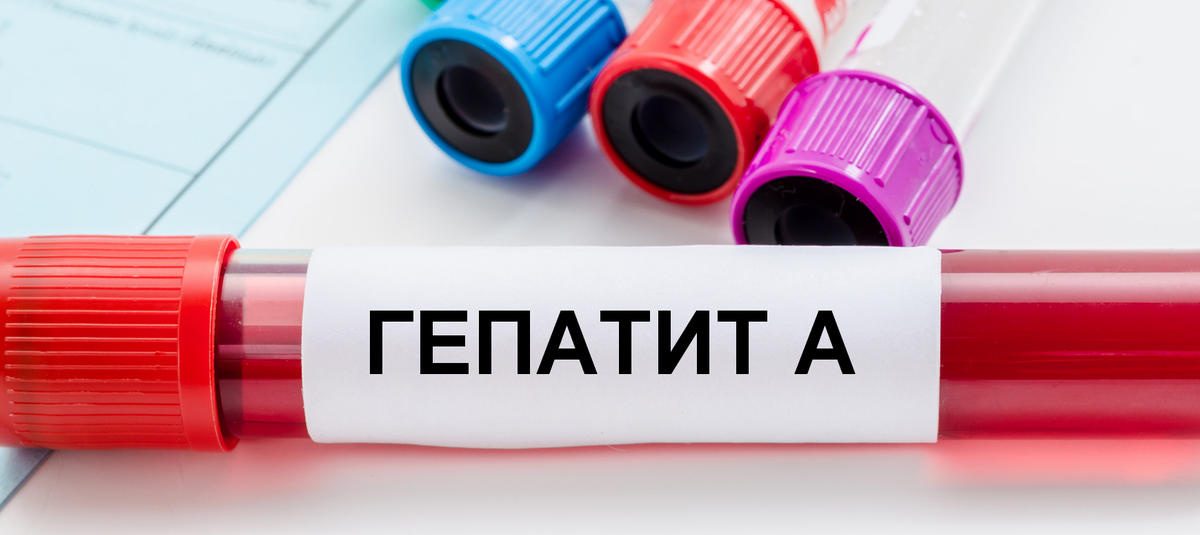 Гепатит А