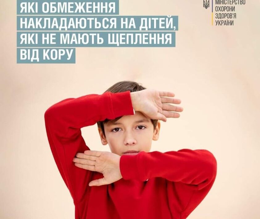 Які обмеження наладаються на дітей, які не мають щеплення від кору