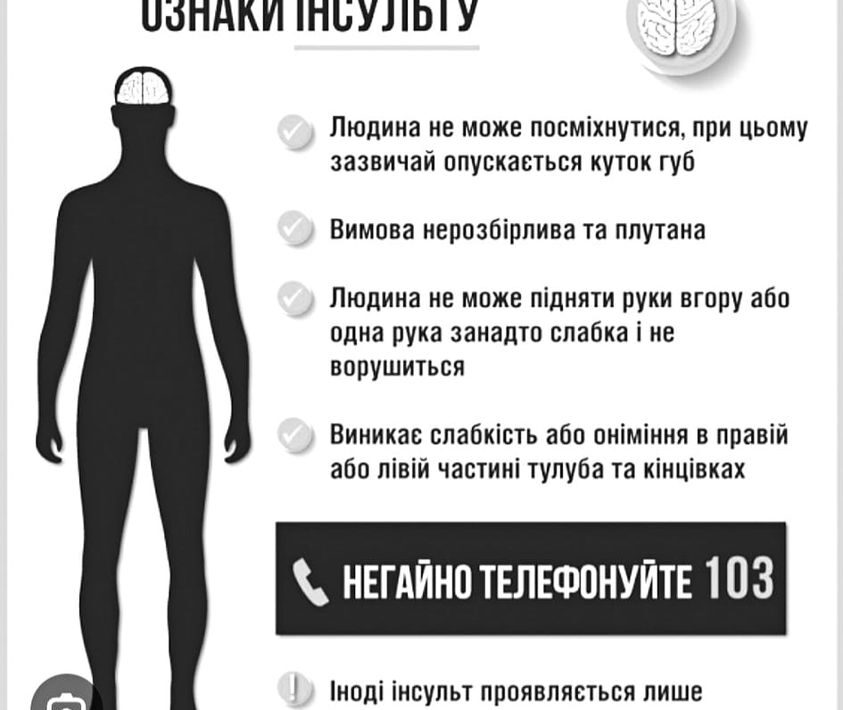 Діагностика та лікування інсульту в Україні мають бути повністю безоплатними для пацієнта