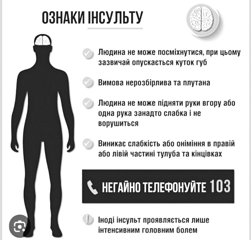 Діагностика та лікування інсульту в Україні мають бути повністю безоплатними для пацієнта Діагностика та лікування інсульту в Україні мають бути повністю безоплатними для пацієнта