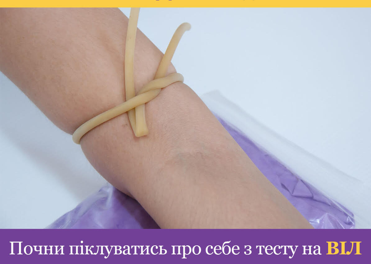 Ми поширюємо безоплатні оральні тести для самотестування на ВІЛ