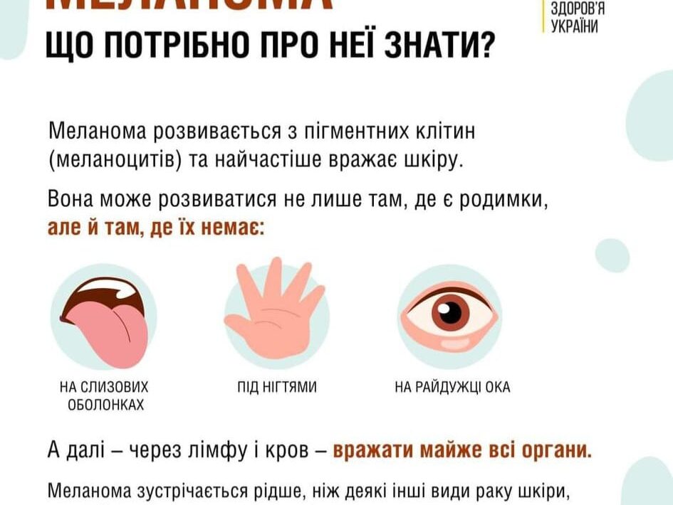 Травень – місяць обізнаності про рак шкіри