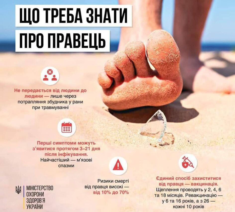 Що треба знати про правець