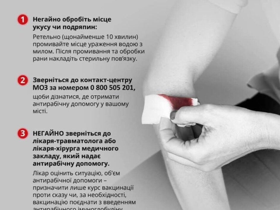 Що важливо знати про сказ?