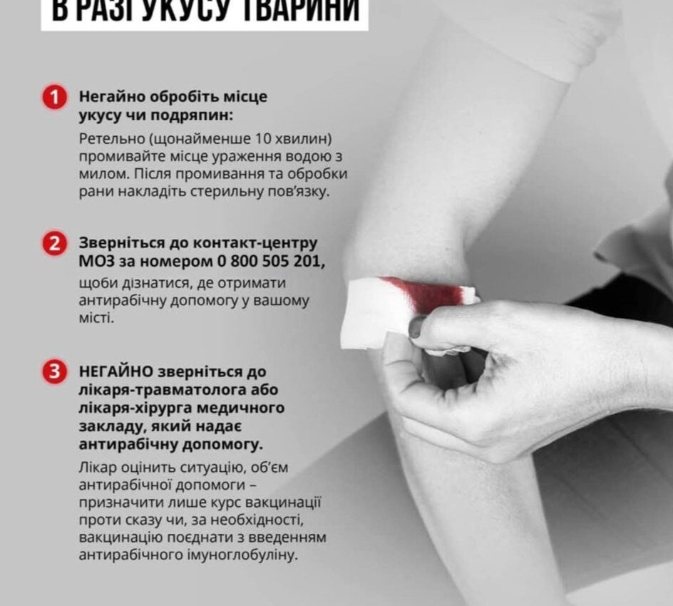 Що важливо знати про сказ? Що важливо знати про сказ?